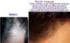 beforeafter9.jpg (154986 bytes)