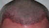 Hairline070403.jpg (377004 bytes)