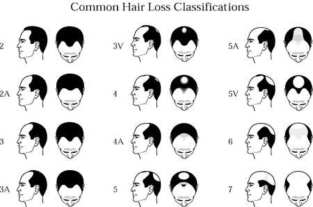 Heads.gif (12012 bytes)