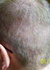benny_leftsidedonor.jpg (393690 bytes)