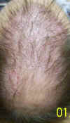 benny_topview.jpg (200785 bytes)