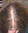 top-of-my-head.jpg (47057 bytes)