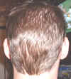 backofhead.JPG (32169 bytes)