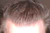 hairline.JPG (27701 bytes)