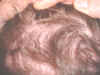 scars2.JPG (23069 bytes)