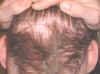 scars.JPG (28839 bytes)