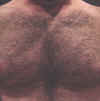 nypatientchest1.jpg (252602 bytes)