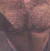 nypatientchest2.jpg (143961 bytes)
