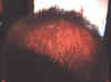 nypatientcrown1.jpg (80211 bytes)
