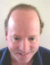 P1010038_After24months_fullface.jpg (15683 bytes)