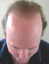 P1010040_After24months_head_down.jpg (18037 bytes)