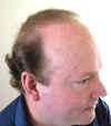 P1010043_After24months_Left_Fullface.jpg (18394 bytes)