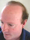 P1010047_After_24months_Leftside.jpg (18429 bytes)