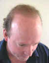 P1010052_After_24months_righthead_down.jpg (16309 bytes)