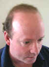P1010053_After_24Months_Rightside.jpg (16271 bytes)