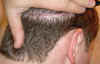 scar2.jpg (192688 bytes)