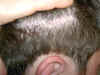 scar4.jpg (147890 bytes)