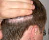 scar6.jpg (179229 bytes)