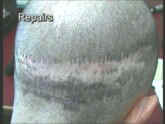 7083k - Before (Right side)
